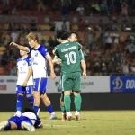 Công Phượng tái phát chấn thương ngay trận tái xuất: Tin vui bất ngờ từ bác sĩ 1